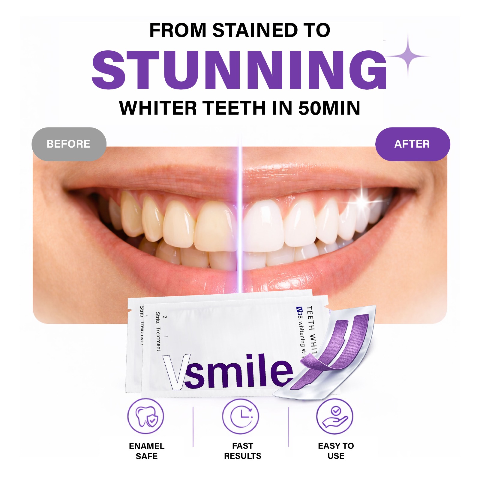 Step 2 — wait 30–50 minutes with VSmile strips for whitening